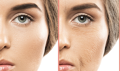 Beneficiile botox-ului